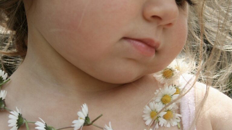 5 Tips for Sensitive Skin This Spring